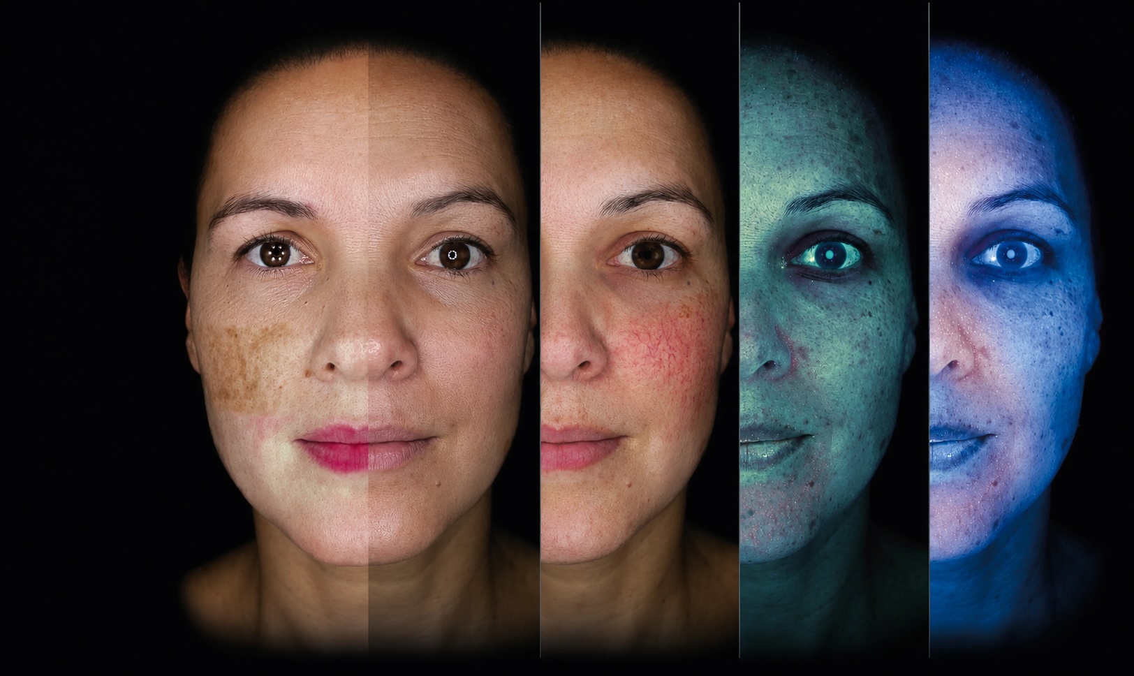 Wellface Skin Scan capture